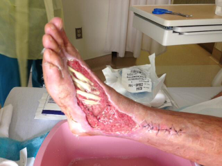 Illustration for article titled Bear Grylls's Producer Got A Horrific Snake Bite (NSFW)